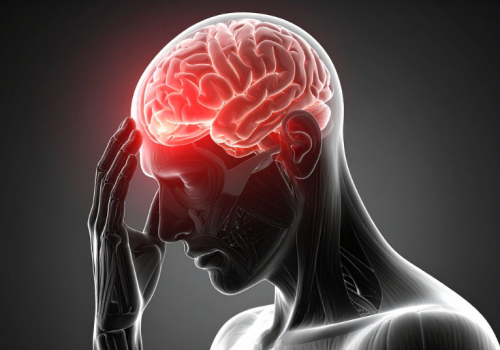 Neurology