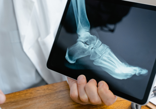 orthopedics